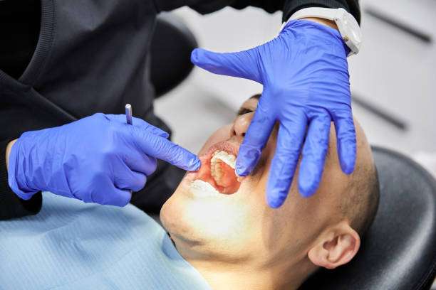 Best Chipped Tooth Repair Near Me  in Nyssa, OR