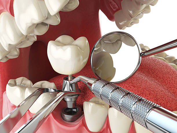 Best Emergency Gum Pain Relief  in Nyssa, OR